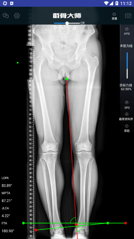 截骨大师app