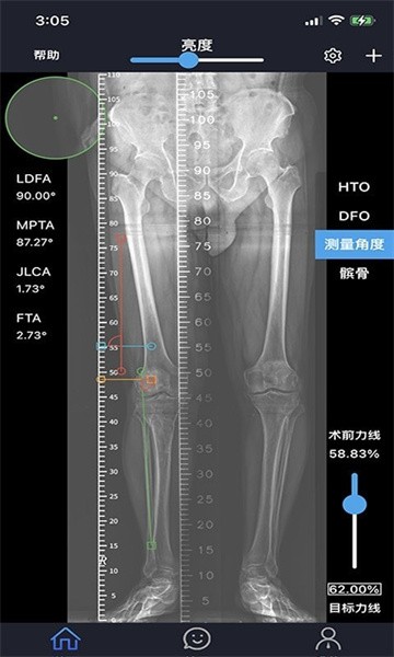 华保膝望app