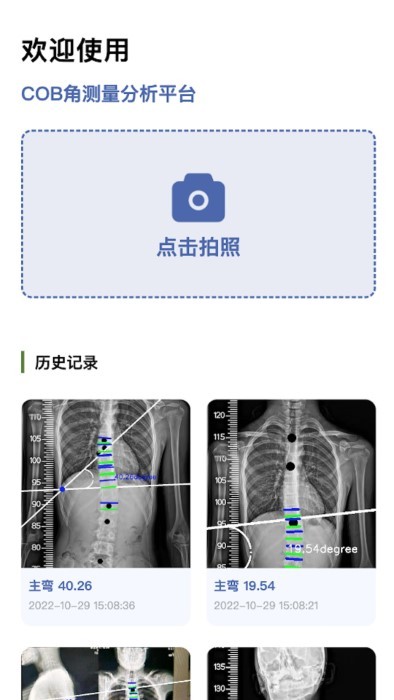 cobb角测量分析平台app